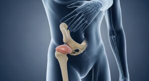 人工関節とは？仕組みや役割、必要とされる理由を徹底解説