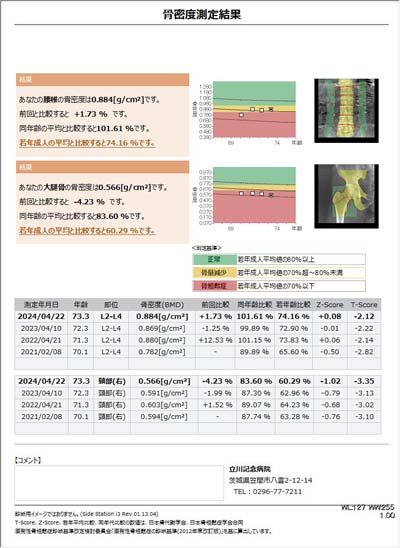 骨密度測定検査