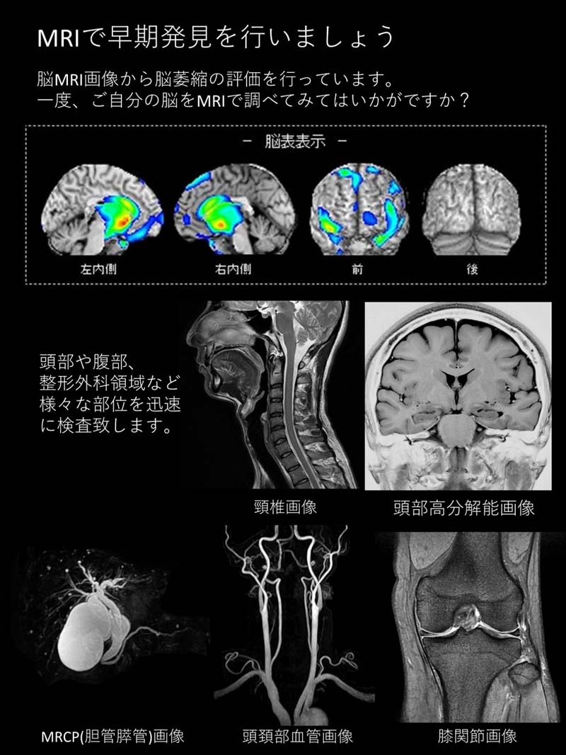 診療機器で早期発見早期治療