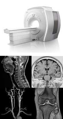 1.5テスラMRI